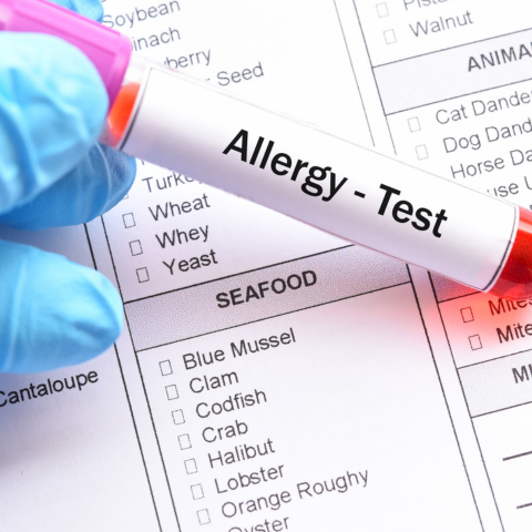 Food allergy test