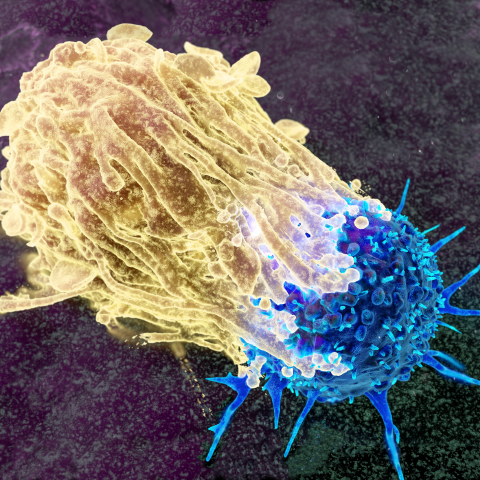 Macrophage attacking a cancer cell, illustration