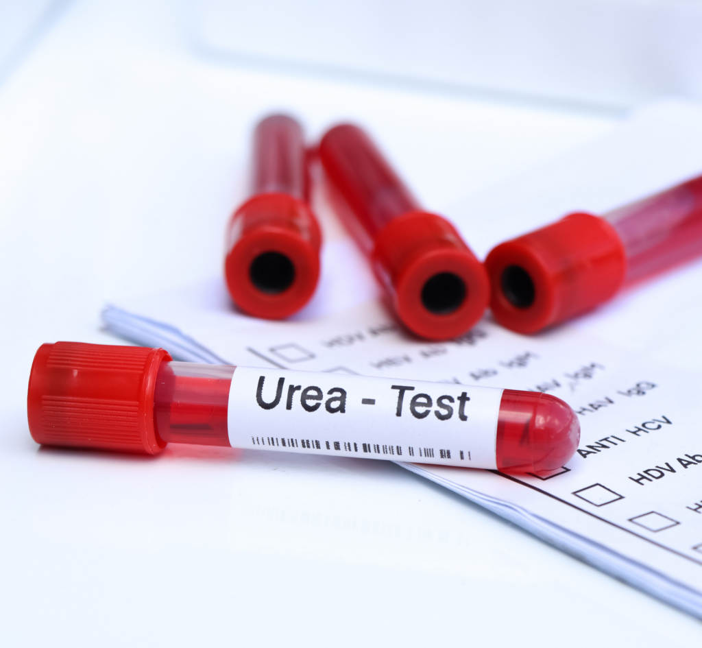 Urea test