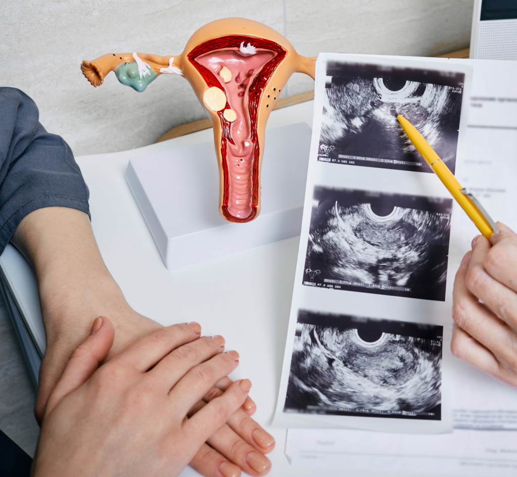 médecin qui montre à une femme une écographie