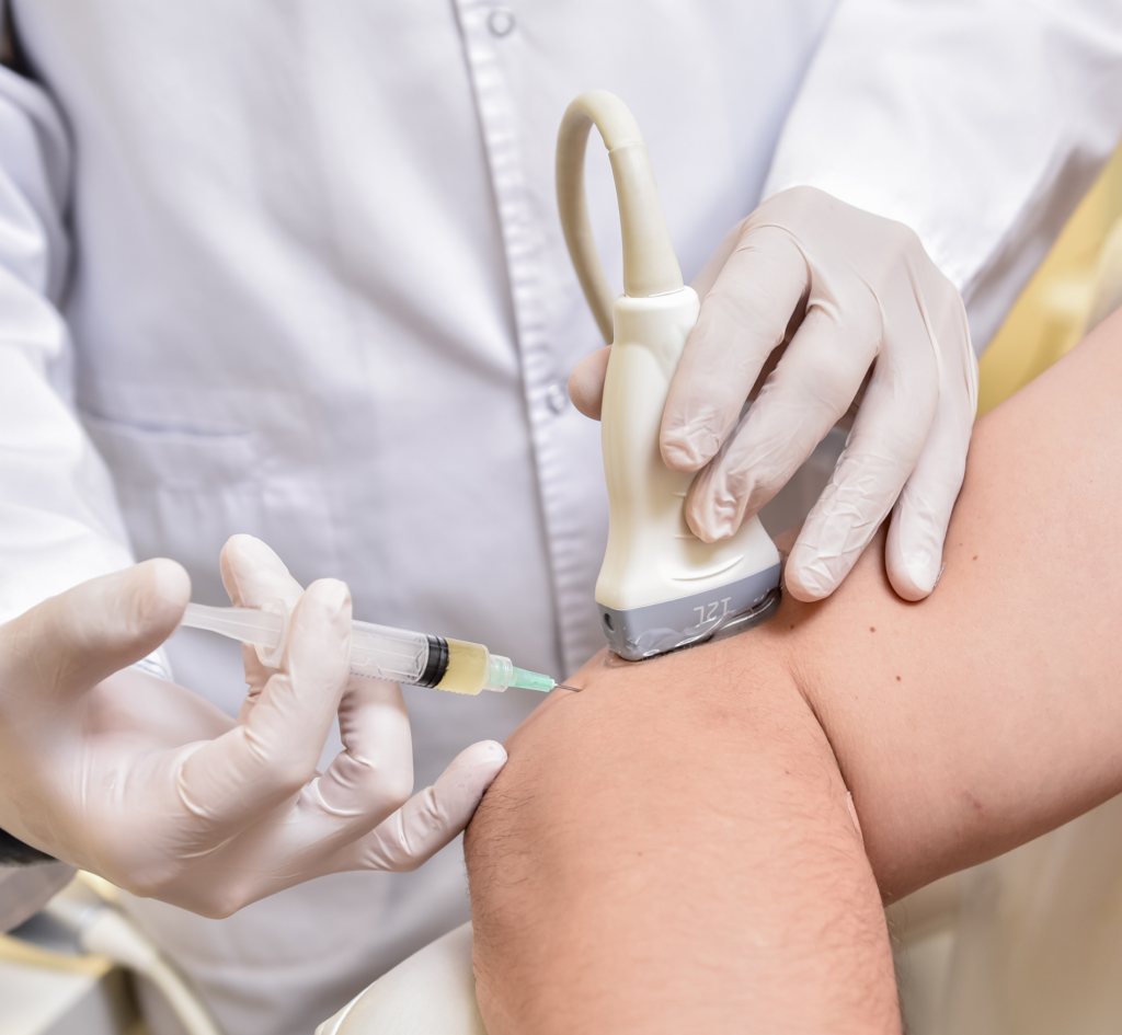 médecin qui réalise une injection sous guidage échographique
