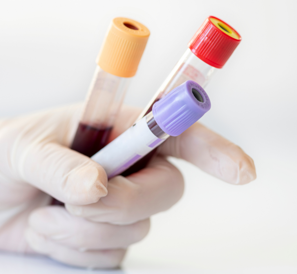 médecin qui tient trois fioles d'analyse de sang